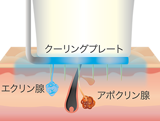 ビューホットの仕組み