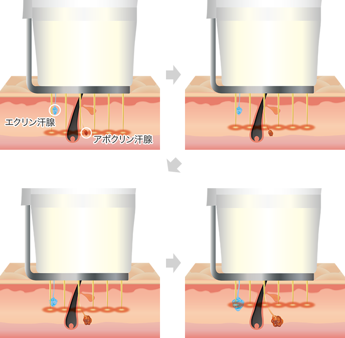ビューホットの仕組み